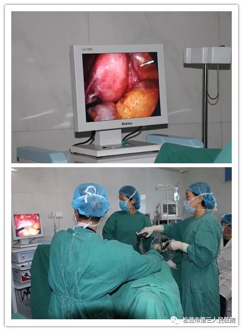 子宫肌瘤微创手术过程图片